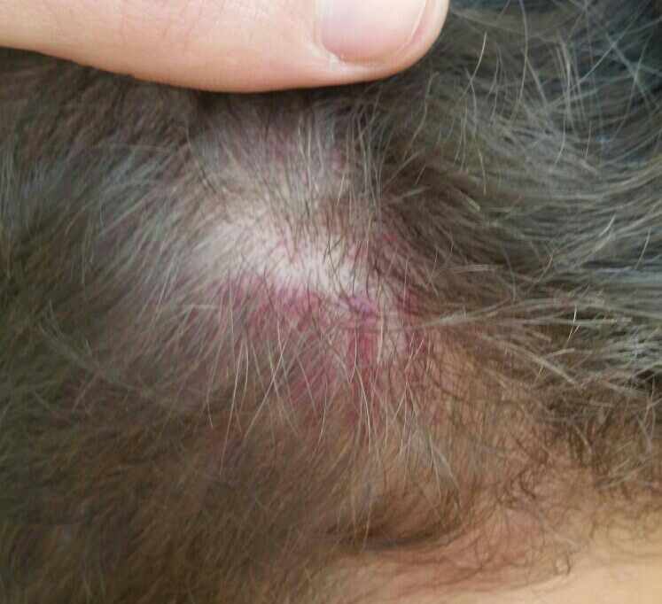 חבורת נערים תקפו באכזריות נערים ונערות באשדוד