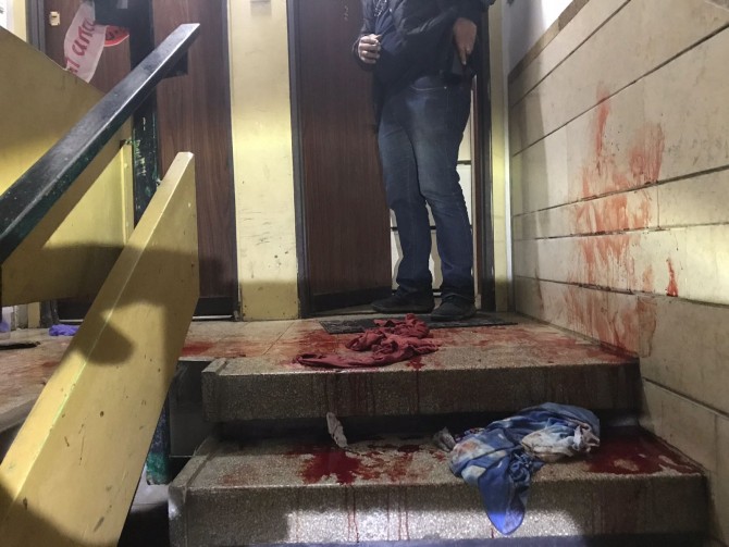 אדם נרצח בכניסה לבניין מגורים - המשטרה פתחה בחקירה