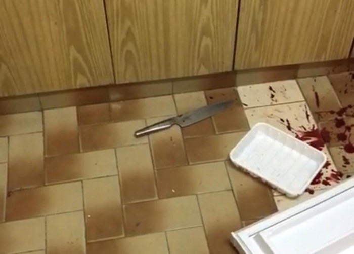 אירוע קשה: דקר את שכנו, תקף בסכין שוטר ונורה באורח קשה